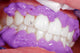 Cosmetic dental cleaning Wall Mural