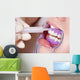 Cosmetic Dental Cleaning Gel