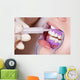 Cosmetic Dental Cleaning Gel