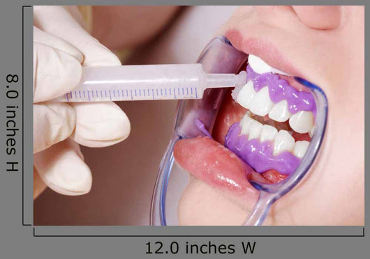 Cosmetic Dental Cleaning Gel