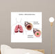 asthma Wall Mural