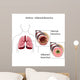 asthma Wall Mural