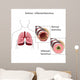 asthma Wall Mural