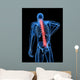 Medical X-ray Male Backache Wall Mural