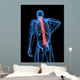 Medical X-ray Male Backache Wall Mural