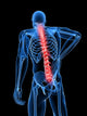 3d rendered medical x-ray illustration -  male backache Wall Mural