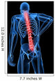 Medical X-ray Male Backache Wall Mural