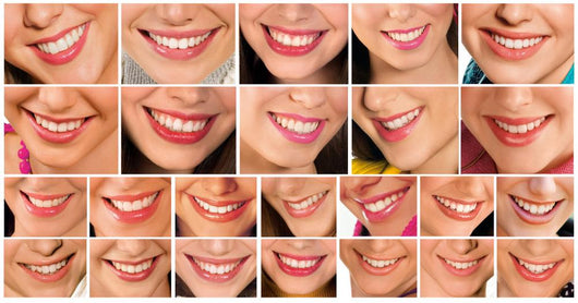 Smiles Collection Wall Decal