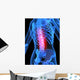 Skeleton with Back Pain Wall Decal