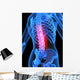 Skeleton with Back Pain Wall Decal