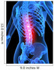 Skeleton with Back Pain Wall Decal