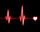 Ekg