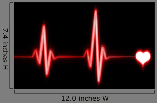 Ekg