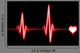 Ekg