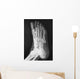 X-ray