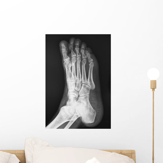 X-ray
