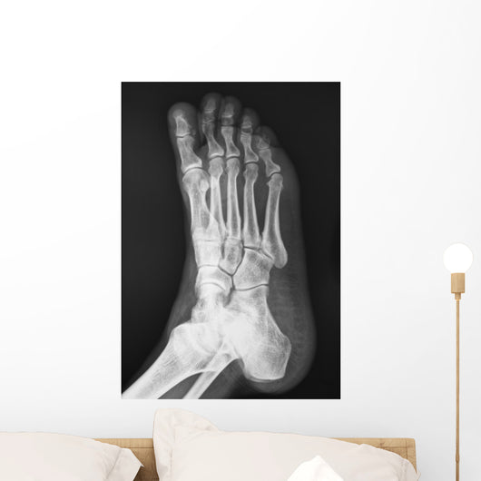 X-ray
