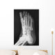 X-ray