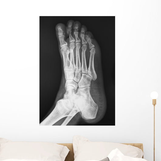 X-ray