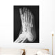 X-ray
