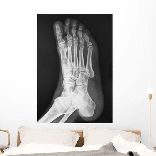 X-ray