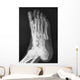 X-ray