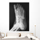 X-ray