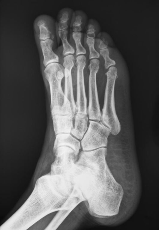 X-ray