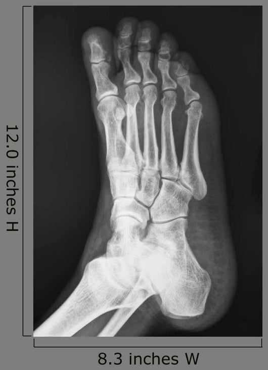 X-ray