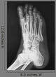 X-ray