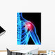 Shoulder Pain X-ray Wall Mural
