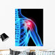 Shoulder Pain X-ray Wall Mural