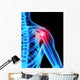 Shoulder Pain X-ray Wall Mural