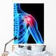 Shoulder Pain X-ray Wall Mural