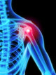 Shoulder Pain X-Ray Wall Mural