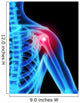 Shoulder Pain X-ray Wall Mural
