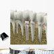 Dental Implant Wall Decal