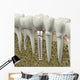 Dental Implant Wall Decal