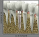 Dental Implant Wall Decal