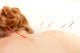 Acupuncture Back Shu Points Wall Decal