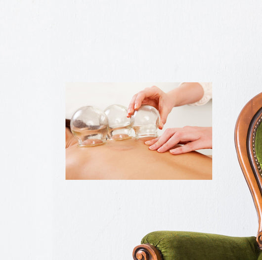 Fire Cupping Removal Glass Wall Decal