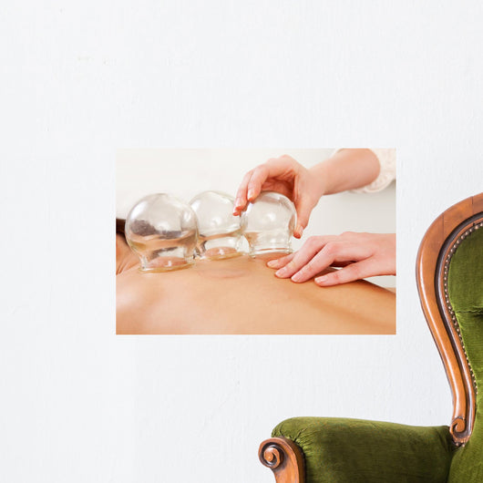 Fire Cupping Removal Glass Wall Decal