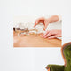 Fire Cupping Removal Glass Wall Decal