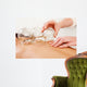 Fire Cupping Removal Glass Wall Decal