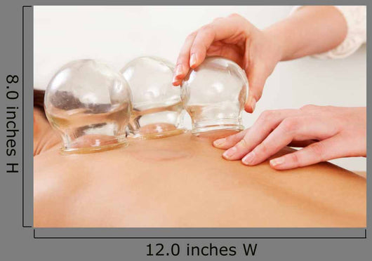 Fire Cupping Removal Glass Wall Decal