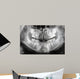x-ray of jaw with teeth and milk teeth Wall Mural