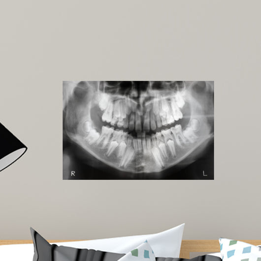 x-ray of jaw with teeth and milk teeth Wall Mural