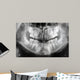 x-ray of jaw with teeth and milk teeth Wall Mural