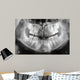 x-ray of jaw with teeth and milk teeth Wall Mural