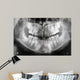 x-ray of jaw with teeth and milk teeth Wall Mural